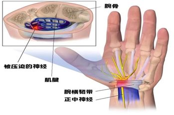 cb1fc09358b32baf56f18458096dff1